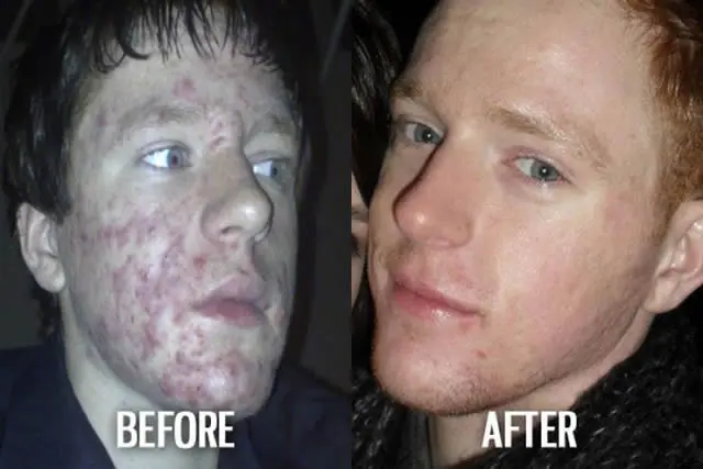 Ugly Duckling Syndrome Before & After (11)
