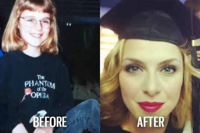 Ugly Duckling Syndrome Before & After (15)