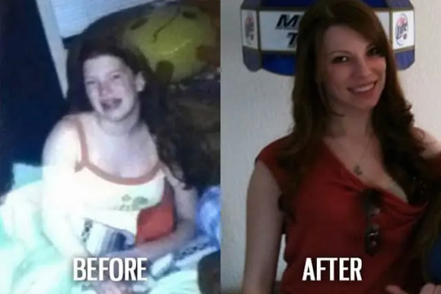 Ugly Duckling Syndrome Before & After (23)