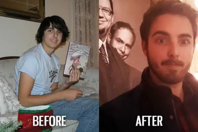 Ugly Duckling Syndrome Before & After (8)